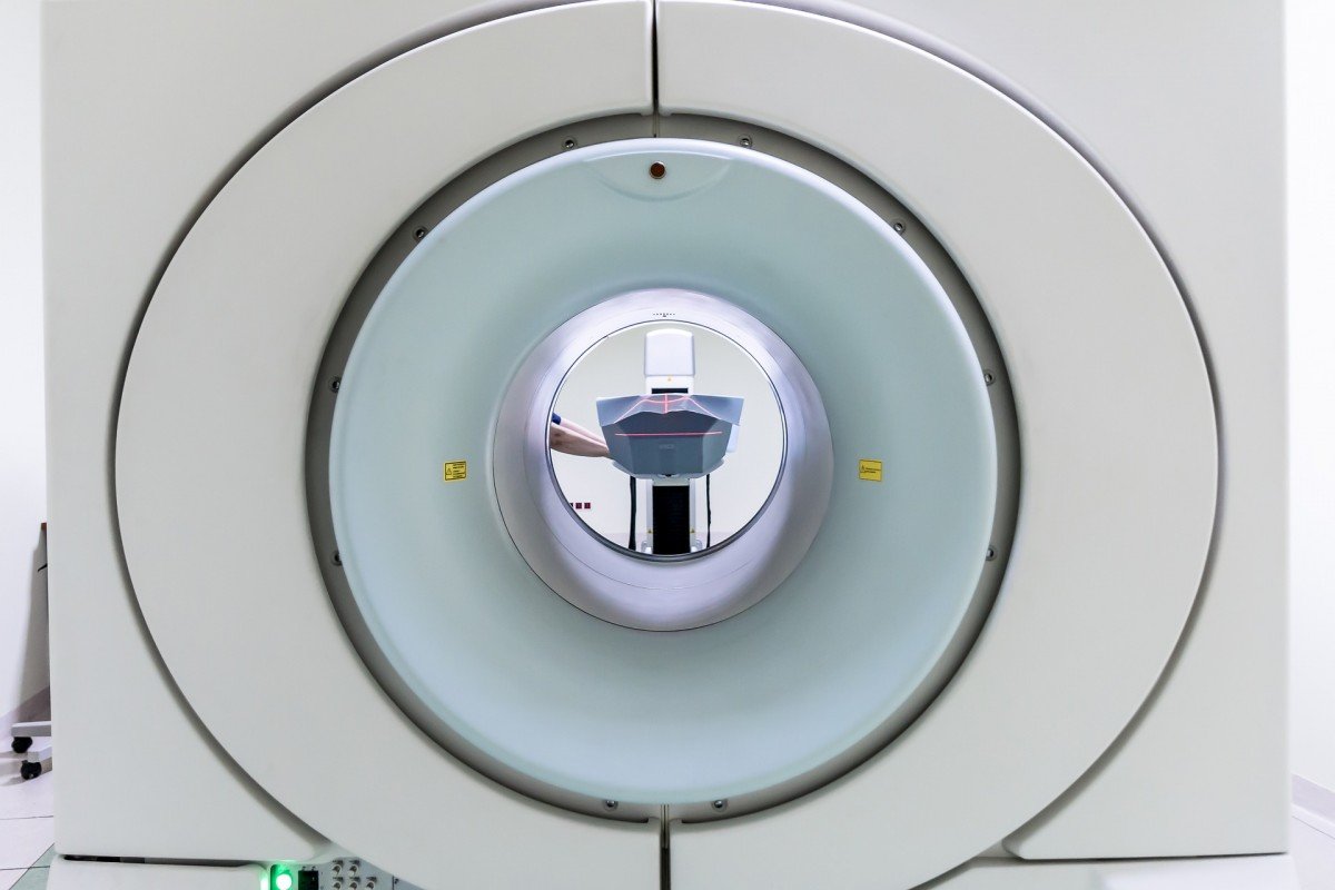 Scannexus: dieper het brein in met MRI