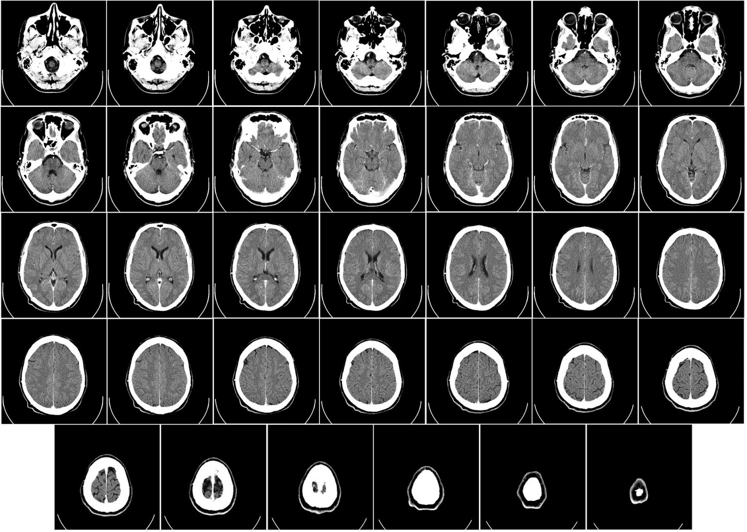 greater-accuracy-in-the-analysis-of-medical-imaging-data-thanks-to-ai