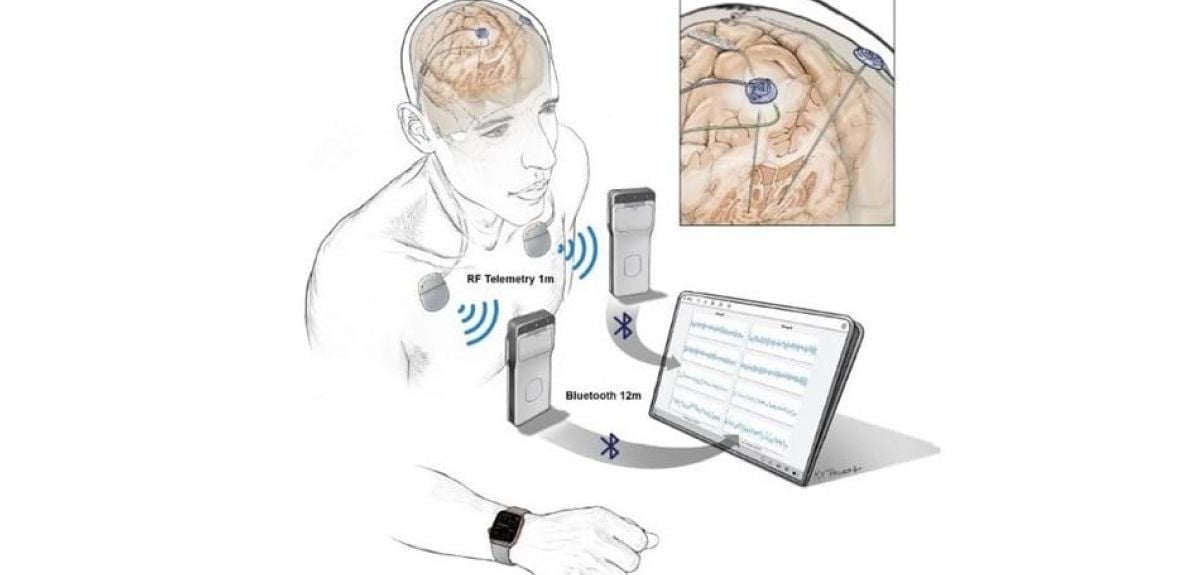 A fitness tracker - but for your brain