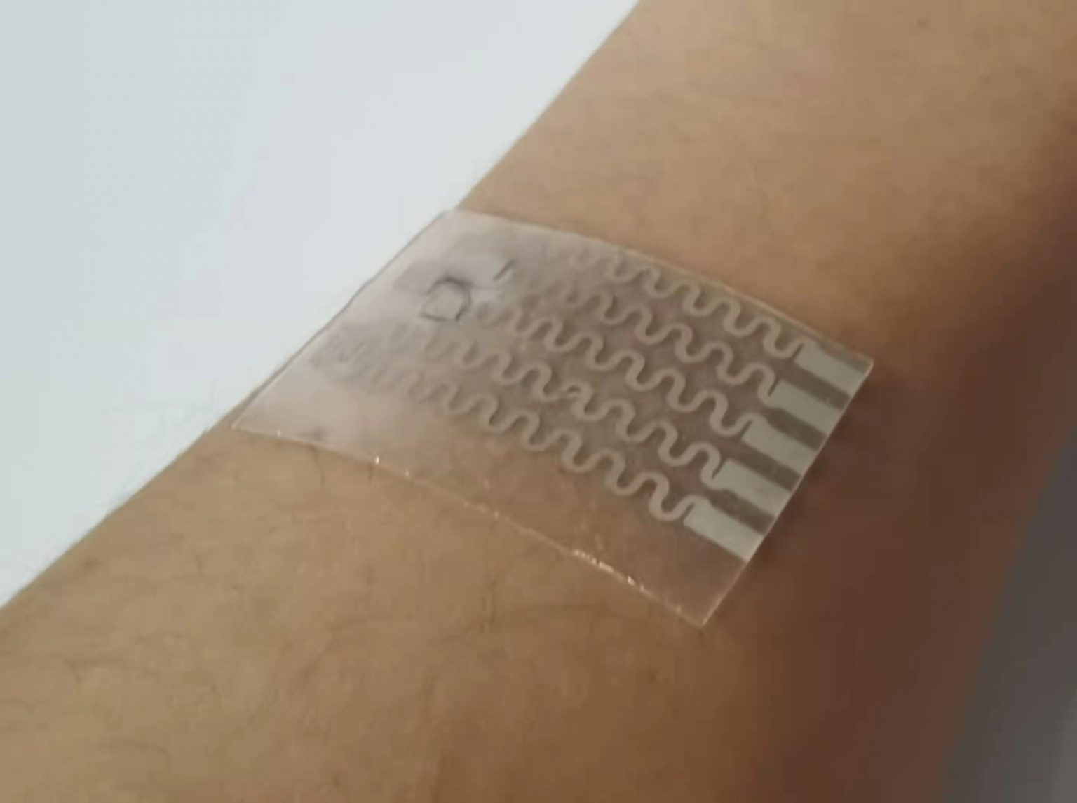 A Smart Bandage Is The Future Of Fighting Infections - Innovation Origins