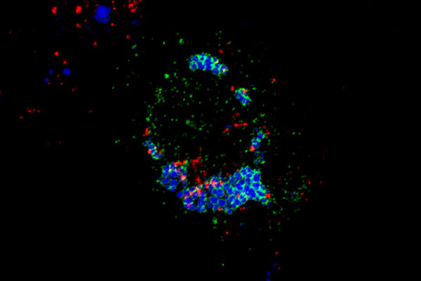 Confocal microscopy image showing SNX13 protein (green) in regions of the endoplasmic reticulum contacting lipid droplets (blue) and lysosomes in which the BMP lipid is present (red).