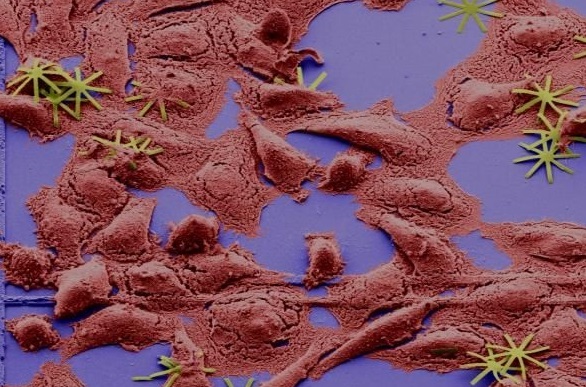 Nanochips penetrate inside cells as mechanical drugs