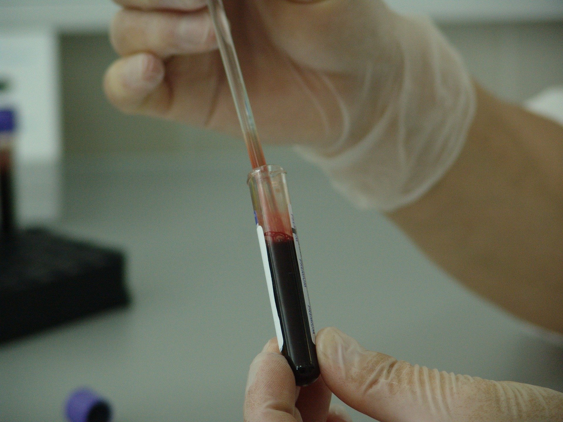 HemostOD will make platelets on demand