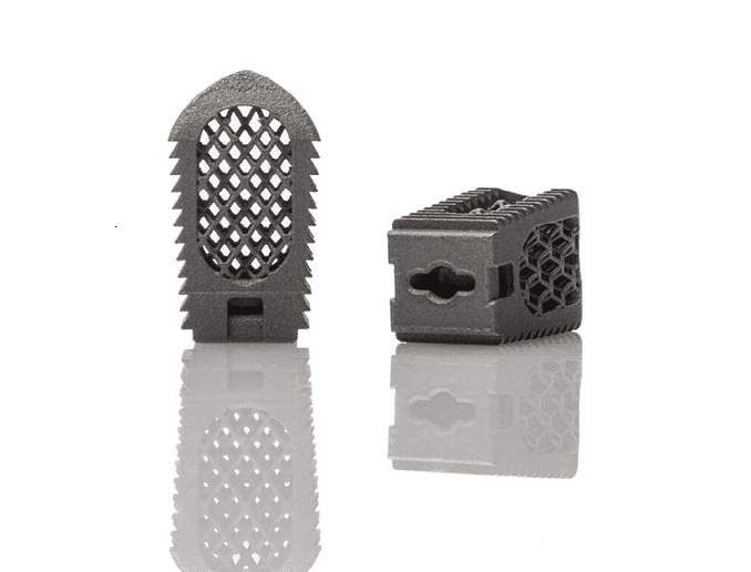 3D-printed spinal implant.