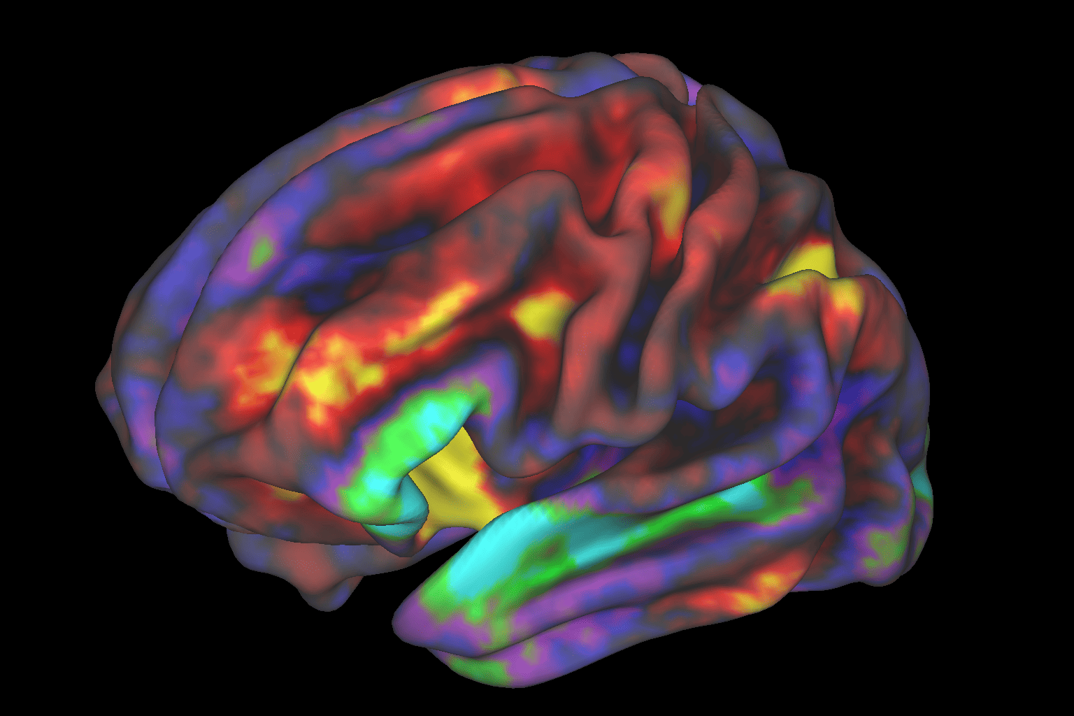 Revolutionizing brain imaging: Rapid fMRI innovations unveiled
