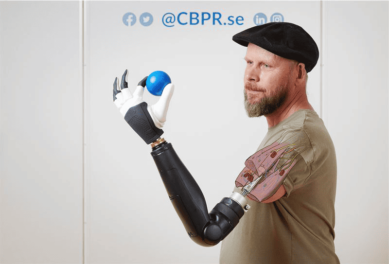 Baanbrekende bionische doorbraken: ongekende controle, adaptief ontwerp en betaalbaar 3D-printen