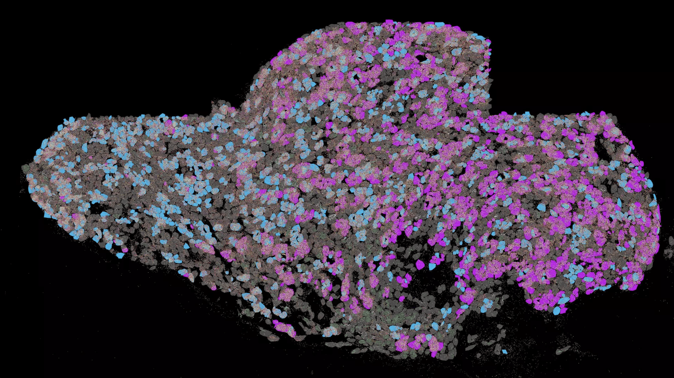 The superior cervical ganglion of a mouse: Here, neurons that control the heart muscle (pink) are in close proximity to those that control the pineal gland (blue).