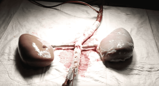 Aorta and kidneys, © Twente University