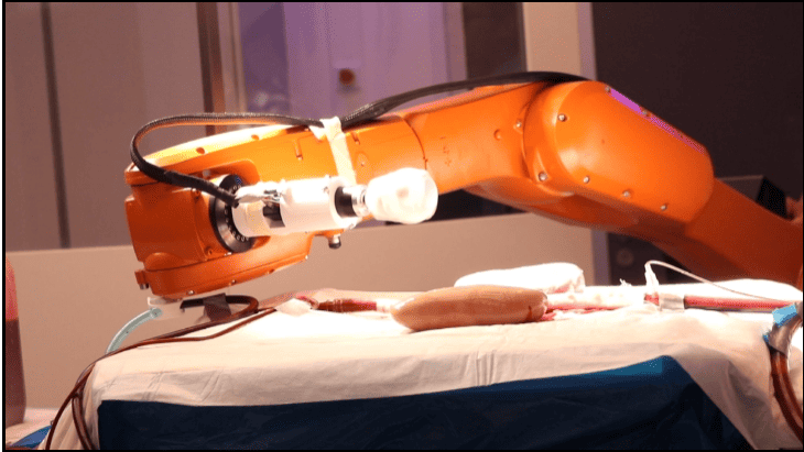 Millirobots op avontuur: draadloze robots navigeren door slagaders